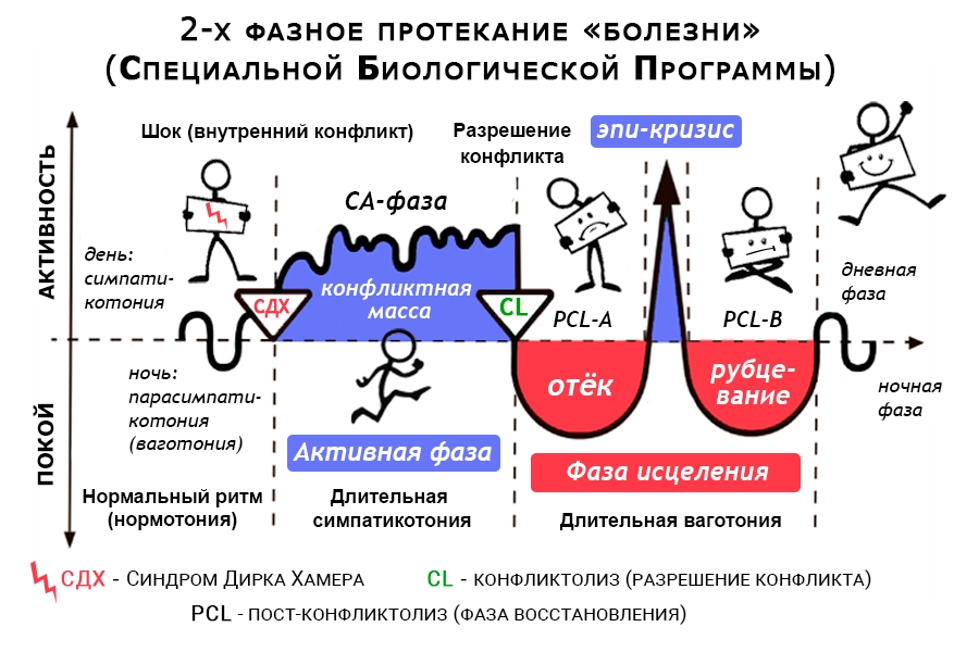 График двухфазного протекания болезни по Хамеру: нормальный биоритм (нормотония), активная CA-фаза конфликта на фоне длительной симпатикотонии, фаза исцеления PCL-A и PCL-B с эпи-кризисом на фоне длительной ваготонии