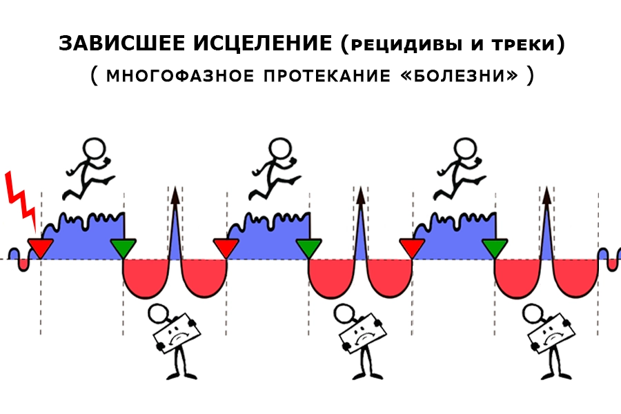 Схема зависшего исцеления: после СДХ «болезнь» протекает многофазно — фаза восстановления не завершается, так как треки (рецидивы) повторно запускают конфликт: активная CA-фаза и стадия восстановления с эпи-кризисом повторяются по кругу
