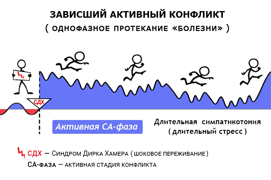 Схема зависшего активного конфликта: после СДХ болезнь протекает однофазно — длительная активная CA-фаза без периодов исцеления, в состоянии длительной симпатикотонии (длительного стресса)