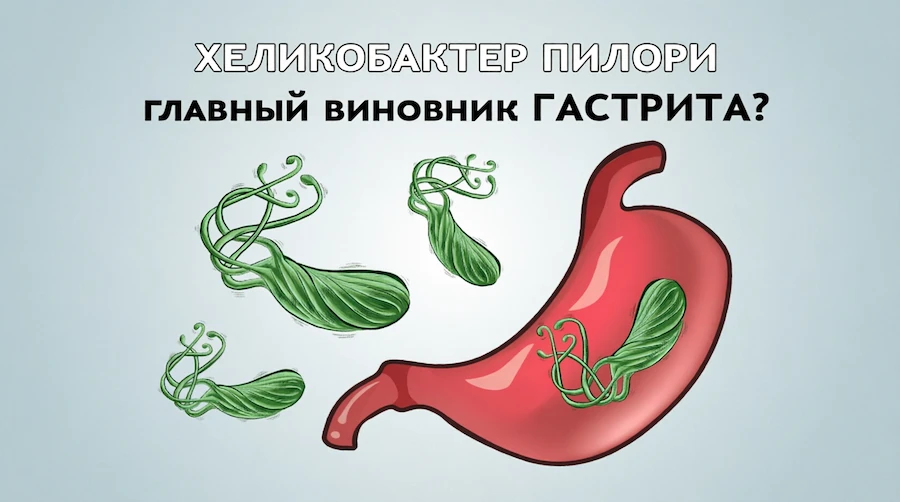 Зелёные спиральные бактерии хеликобактер пилори рядом с желудком и внутри него, надпись «Хеликобактер пилори — главный виновник гастрита?»: иллюстрация к статье о том, что по Германской Новой Медицине эта бактерия не причина гастрита, а помощник и сигнал о нарушении среды желудка