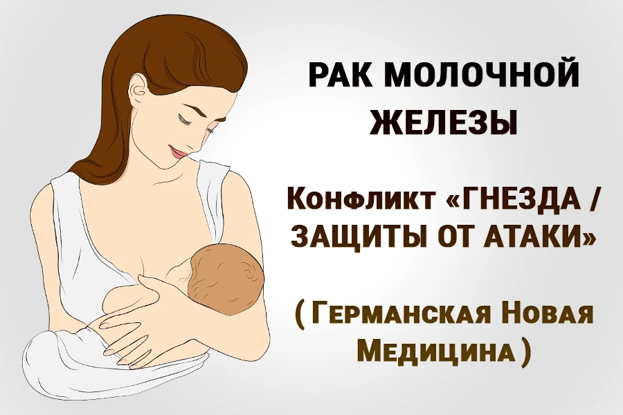Женщина кормит грудью младенца, надписи «Рак молочной железы», «Конфликт ГНЕЗДА / ЗАЩИТЫ ОТ АТАКИ», «Новая Германская Медицина»: иллюстрация к 4-му биологическому закону Хамера о том, что рак молочной железы связан со старой мезодермой и конфликтом беспокойства о потомстве
