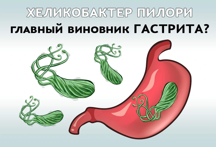 Хеликобактер пилори (helicobacter pilori) и гастрит